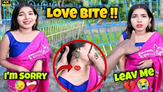 Kissing Prank Gone Wrong💔 Found Love Bite💋🤬Ankur000 [upl. by Ruben]