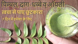 Pimple Daag Dhabbe व Oily Skin से पाए छुटकारा पाए हमेशा के लिए How To Remove Pimple Pimple Marks [upl. by Ivers]