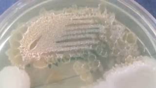 Moraxella lacunata  Pitted colonies [upl. by Suirtemed658]