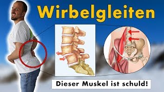 Gleitwirbel Wirbelgleiten wegtrainieren  GENAUE Ursache und 1 Übungen die NACHHALTIG hilft [upl. by Hadik]