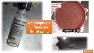 Haemophilus influenzae Colony Morphology Growth around XV factors and serotyping [upl. by Garek]