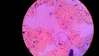 Live MicrofilariaParasite In Blood Under Microscope Captured In My Camera [upl. by Ailbert]