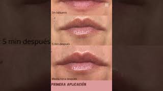 El Secreto de unos Labios Irresistibles que Tienes que Probar skincare beauty simonourianmd [upl. by Ettezyl]