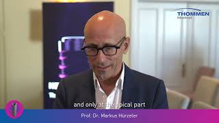 NEVO Testimonial Dr Hürzeler [upl. by Jp]