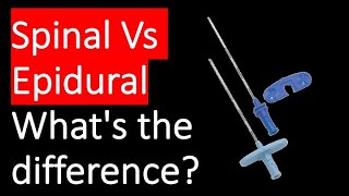 Whats the difference between spinal and epidural anaesthesia [upl. by Auginahs19]