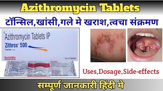 Zithrox 500 TabletsAzithromycin Tablets usesDosageSideeffects in hindiPharma with Vikram [upl. by Eanerb]