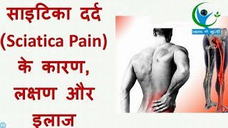 क्यों होता है साइटिका का दर्द कैसें करें घरेलू उपाय Don’t ignore sciatica pain  Home Tips [upl. by Ano]