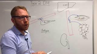 Type 2 Diabetes Pathophysiology [upl. by Leigha]