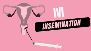 How to do at Home IVI Insemination [upl. by Nomrej]