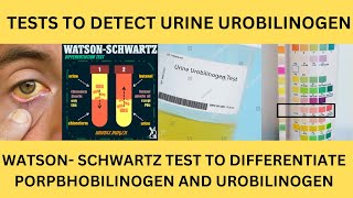 TESTS TO DETECT UROBILINOGEN IN THE URINE EhrlichsTEST PORPHOBILINOGEN TESTWatsonSchwartz Test [upl. by Viens759]