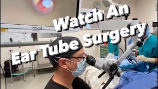 Ear Tube Surgery actual video  myringotomy tympanostomy ventilation tube placement [upl. by Che]