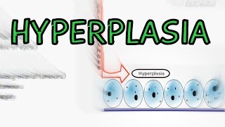 Hyperplasia  Physiological vs Pathological  Explained in 2 Minutes [upl. by Nuahsar359]