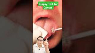 biopsy test for cancer shortvideo shortsviral shorts short [upl. by Hairu499]