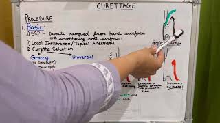 Curettage  Dental Notes 1 [upl. by Rumit]