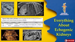 Everything about Echogenic Kidneys [upl. by Adamo98]