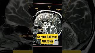 Corpus Callosum Anatomy shorts viral shortsvideo [upl. by Ainiger]