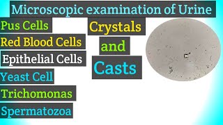 Urine under Microscope  Medical lab Technologist [upl. by Korry]