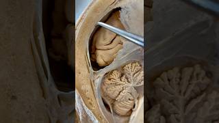 Incredible Tissue Surrounding Your Brain  Institute of Human Anatomy [upl. by Popele]