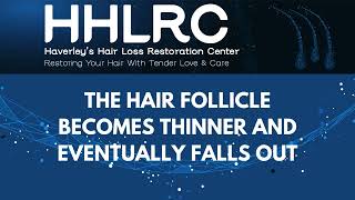 How dihydrotestosterone DHT affect Hair Loss Video 24 [upl. by Maximo]