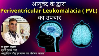 Periventricular Leukomalacia  Causes Symptoms and Treatment in Ayurveda  डॉ पुनीत द्विवेदी [upl. by Lukey]