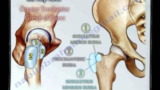 Bursitis Around The Hip  Everything You Need To Know  Dr Nabil Ebraheim [upl. by Yenruoj]