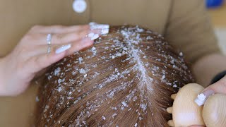 Satisfying ASMR  Dandruff Removal with Herbal Materials [upl. by Akieluz]