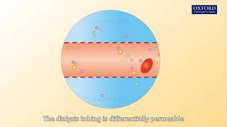 Animation E1 12 How does a dialysis machine work [upl. by Blake]