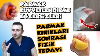 El Parmak KırığıBoksör Kırığı Fizyoterapisi ve Parmak Kuvvetlendirme Egzersizleri [upl. by Raynard]