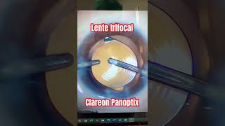 panoptix lentetrifocal [upl. by Borden]