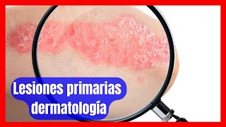 Claves para el Diagnóstico Dermatológico Descripción y Clasificación de Lesiones Primarias [upl. by Bilac]