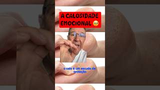 Você já ouviu falar da Calosidade Emocional🥹 ⁉️  reflexologia Podal  Método SPO [upl. by Windham679]