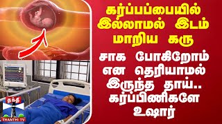 கர்ப்பப்பையில் இல்லாமல் இடம் மாறிய கரு சாக போகிறோம் என தெரியாமல் இருந்த தாய் கர்ப்பிணிகளே உஷார் [upl. by Aetnuahs]