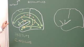 Neuroanatomie 9 substance blanche cérébrale ventricules latéraux Lateral ventricles [upl. by Ayirp]