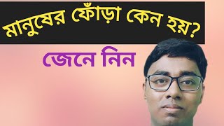 মানুষের ফোঁড়া কেন হয়why do people get boilslsciencezone ফোঁড়া boils fora মানুষেরফোঁড়া [upl. by Nelyag]