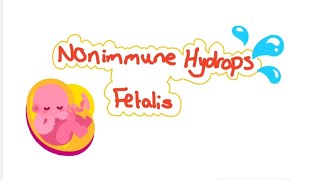 Nonimmune hydrops fetalis [upl. by Bebe896]