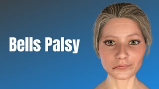 VIDEO What is Bells palsy Symptoms treatment and recovery [upl. by Norrat]