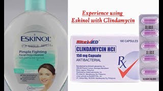 2019 Acne Story Part 1 EXPERIENCE Eskinol with dalacin cclindamycin [upl. by Key]