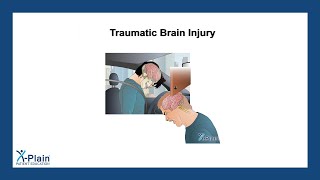 Traumatic Brain Injury [upl. by Osher]