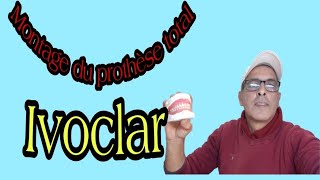 Montage de la prothèse totale avec les dents quotIvoclarquot [upl. by Ecyaj552]