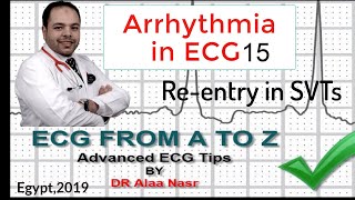 ECG from A to Z intermediate level Arrhythmia 15 Dr Alaa Nasr 2019 [upl. by Enileme]