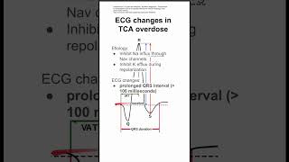 Electrocardiography EKG changes in tricyclic antidepressant overdose [upl. by Blunk]