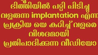 Implantation Explained The First Step in Pregnancy [upl. by Sivat]