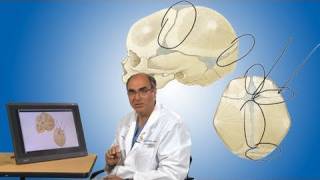 Plagiocephaly and its treatment  Boston Children’s Hospital [upl. by Eenert667]