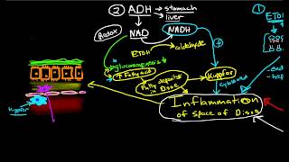 Pathophysiology of Cirrhosis [upl. by Dressler]