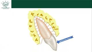 Biological response of tooth to light orthodontic force [upl. by Attiuqram]