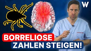 Zeckenalarm BorrelioseSymptome erkennen Die Gefahr der Neuroborreliose  BorrelioseBehandlung [upl. by Val164]