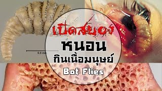 หนอนกินเนื้อมนุษย์ BotFlies [upl. by Ynaffyt905]