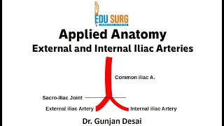 Anatomy essentials  Internal iliac artery branches External iliac artery May Thurner Syndrome [upl. by Meadows]