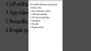 Norcet topic  MI in ECG [upl. by Alekal]