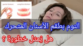 النوم بطقم الأسنان المتحرك، هل له خطورة؟ Dormir avec prothèse dentaire amovible [upl. by Ayotl169]